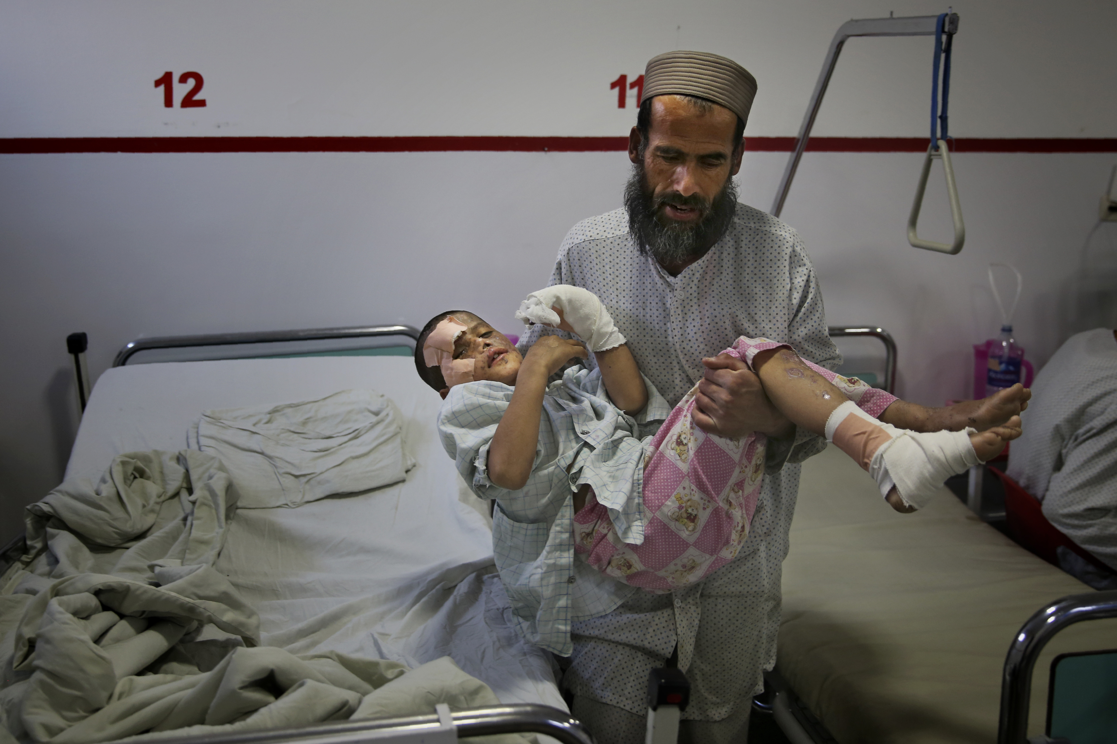 In this Thursday, Dec. 12, 2019, photo, Ismatullah carries his nine-year-old son Eimal, who has lost his right eye and several fingers on his hands in a landmine blast, for bathroom at Emergency Surgical Center for Civilian War Victims in Kabul, Afghanistan. The total number of children killed or maimed in more than four decades long Afghan war is not known. But, with a population where close to 50% are under the age of 20, the losses among the young is tremendous. (AP Photo/Altaf Qadri)