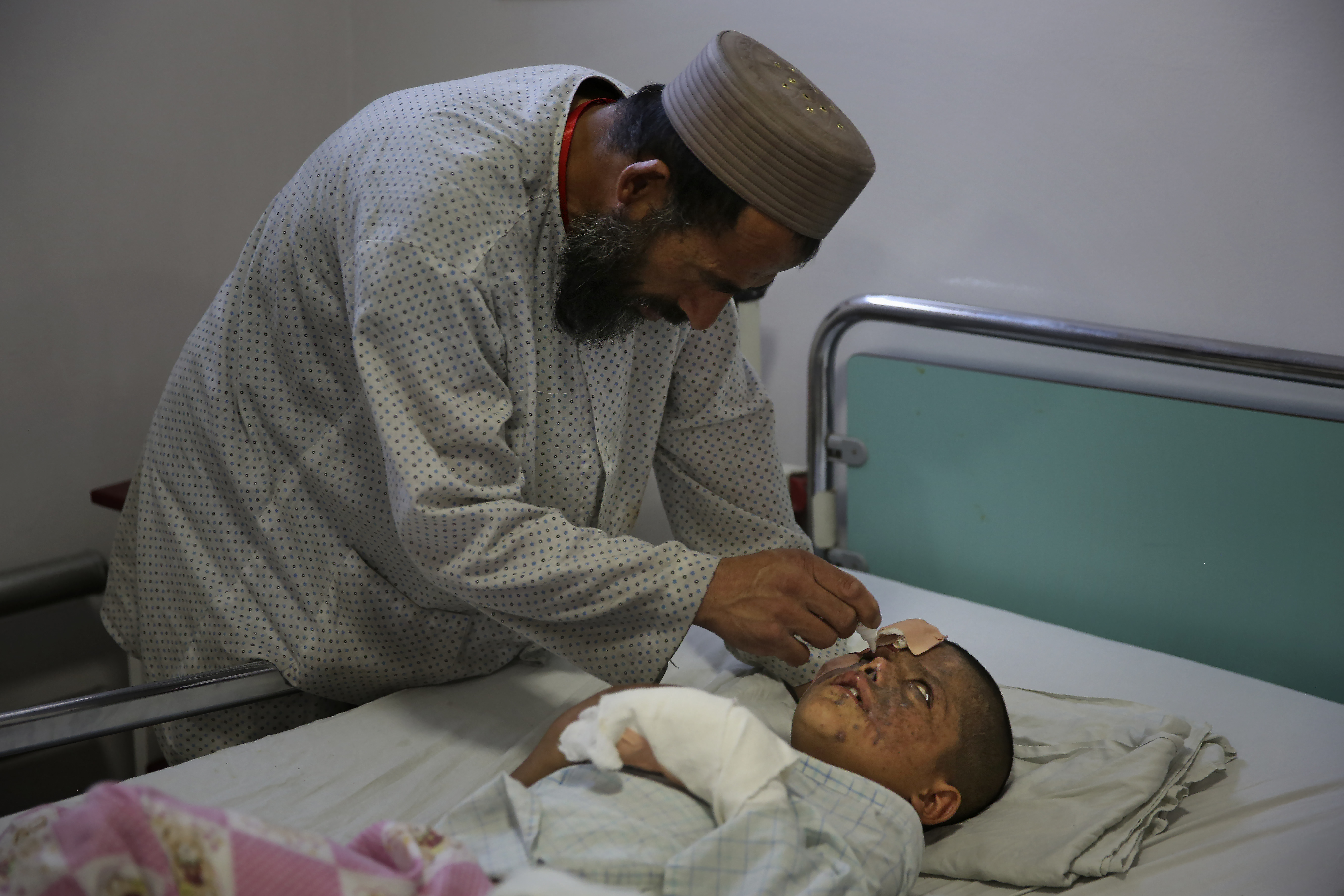In this Thursday, Dec. 12, 2019, photo, Ismatullah attends to his nine-year-old son Eimal, who has lost his right eye and several fingers on his hands in a landmine blast, at Emergency Surgical Center for Civilian War Victims in Kabul, Afghanistan. The total number of children killed or maimed in more than four decades long Afghan war is not known. But, with a population where close to 50% are under the age of 20, the losses among the young is tremendous. (AP Photo/Altaf Qadri)