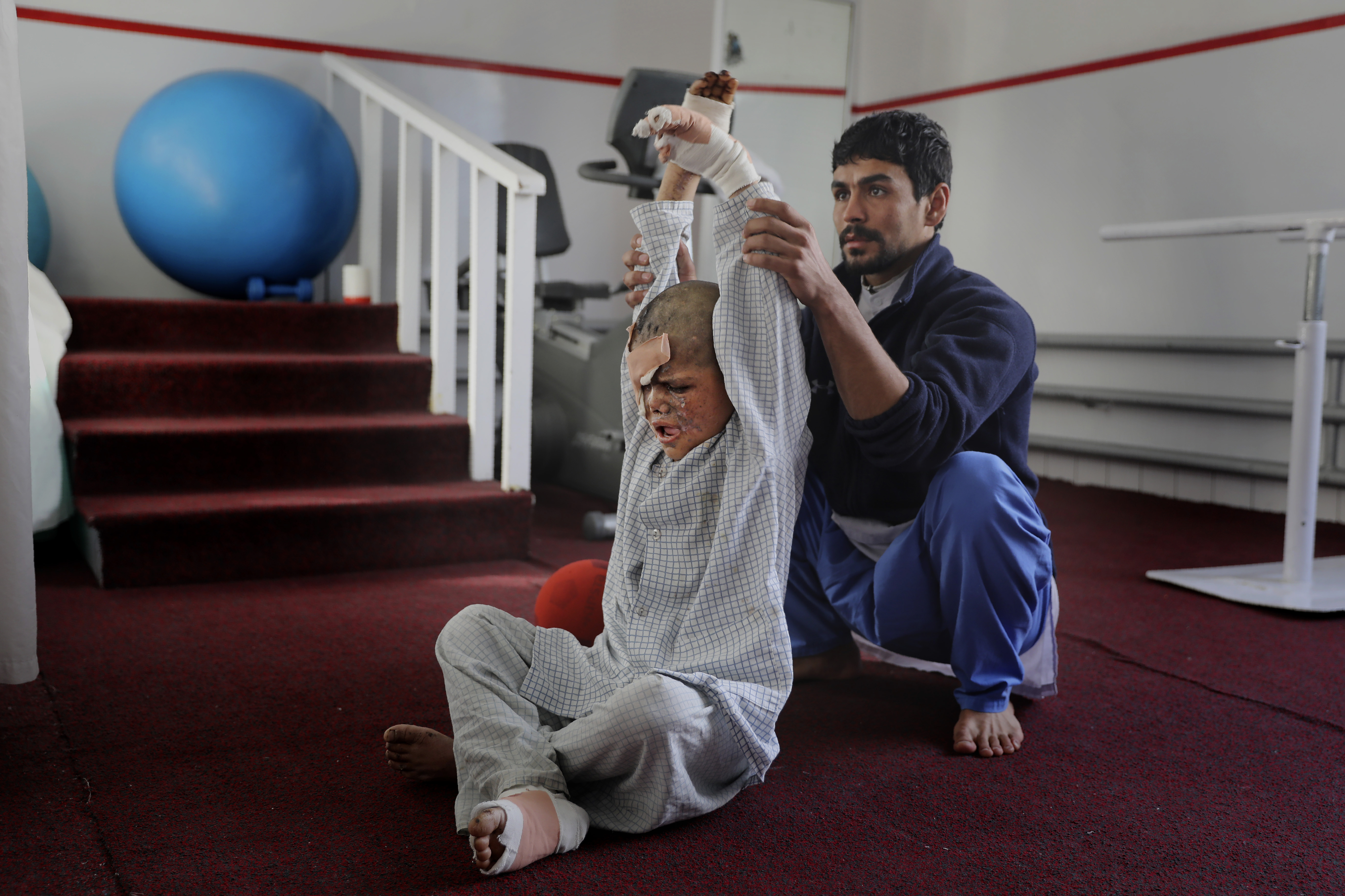 In this Thursday, Dec. 5, 2019, photo, an Afghan physiotherapist helps nine-year-old Eimal, who has lost his right eye and several fingers on his hands in a landmine blast, stretch at Emergency Surgical Center for Civilian War Victims in Kabul, Afghanistan. The total number of children killed or maimed in more than four decades long Afghan war is not known. But, with a population where close to 50% are under the age of 20, the losses among the young is tremendous. (AP Photo/Altaf Qadri)