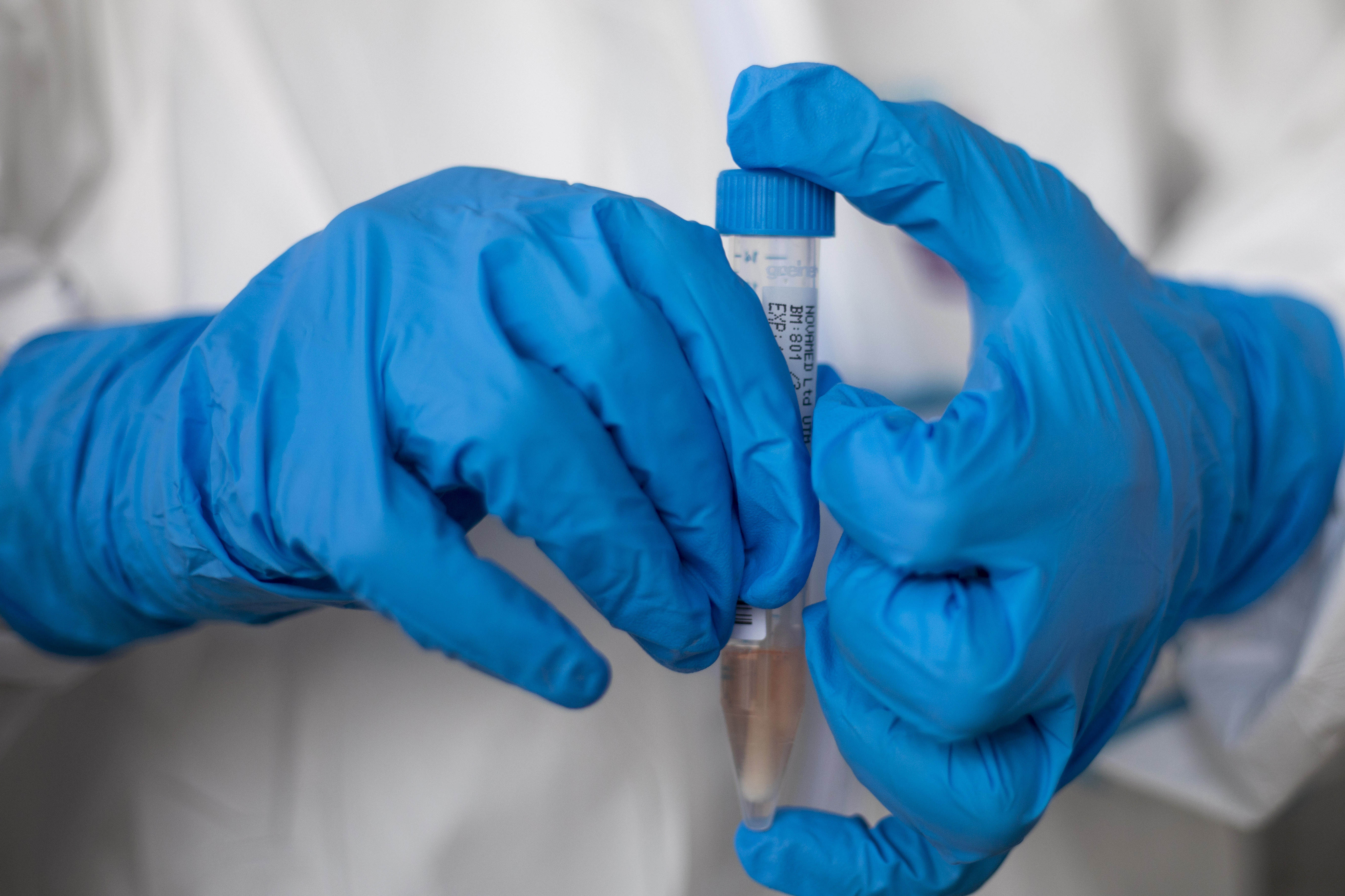 A healthcare worker holds a test tube at a drive-thru COVID-19 testing centre set up at a parking area in east Jerusalem neighborhood of Sheikh Jarrah, Thursday, Sept. 10, 2020. Israel this week imposed new restrictions on some 40 cities and towns with worrying outbreaks, which include nighttime curfews, strict limits on public gatherings and the shuttering of schools. The restrictions mostly affect ultra-Orthodox as well as Arab communities, which have also been hit hard in recent weeks. (AP Photo/Ariel Schalit)