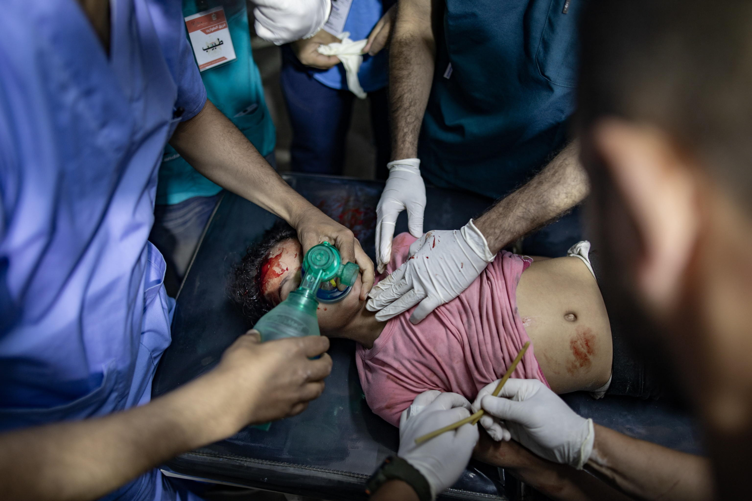 Un bambino palestinese ferito a seguito di un attacco israeliano, viene visitato dai medici dell'ospedale Al Kuwaiti a Rafah, nel sud della Striscia di Gaza, l'8 maggio 2024. Foto: EPA/HAITHAM IMAD EPA-EFE/HAITHAM IMAD via Ansa