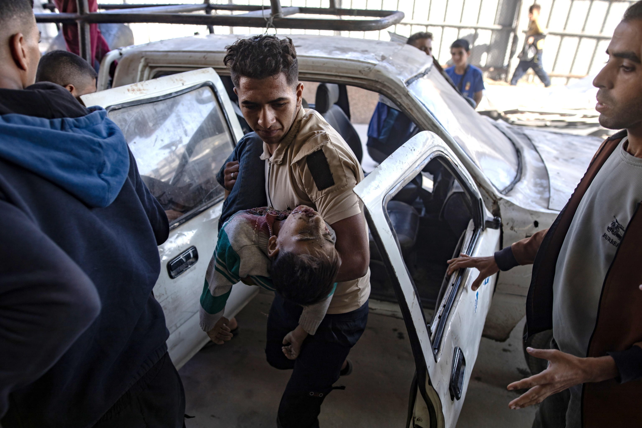 epa11699141 A Palestinian child, injured during an Israeli airstrike, is brought to Nasser Hospital following an attack that claimed the lives of at least eight people in Khan Yunis, southern Gaza Strip, 03 November 2024. More than 43,000 Palestinians and over 1,400 Israelis have been killed, according to the Palestinian Health Ministry and the Israel Defense Forces (IDF), since Hamas militants launched an attack against Israel from the Gaza Strip on 07 October 2023, and the Israeli operations in Gaza and the West Bank which followed it.  EPA/HAITHAM IMAD ATTENTION EDITORS: GRAPHIC CONTENT