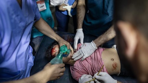 Un bambino palestinese ferito a seguito di un attacco israeliano, viene visitato dai medici dell'ospedale Al Kuwaiti a Rafah, nel sud della Striscia di Gaza, l'8 maggio 2024. Foto: EPA/HAITHAM IMAD EPA-EFE/HAITHAM IMAD via Ansa